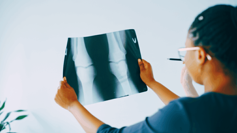 Looking beyond the scan: A physiotherapist’s perspective on medical imaging for seniors